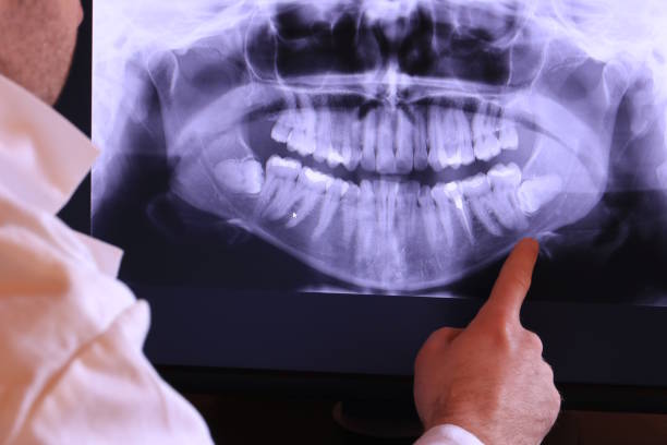 Best Cracked Tooth Emergency Dentist  in Springboro, OH