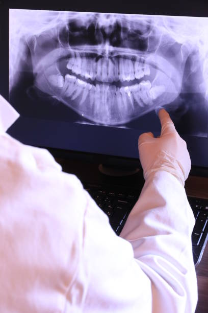 Best Urgent Tooth Repair  in Springboro, OH