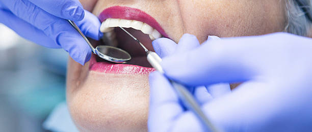 Best Dentist for Tooth Abscess  in Springboro, OH